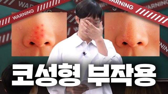 THEDOOR TV 썸네일 — WARNING 코성형 부작용