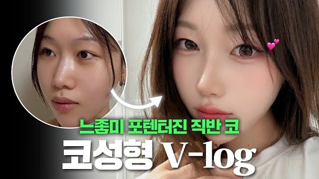 V LOG 썸네일 — 느좋미 포텐터진 직반 코 코성형 V-log