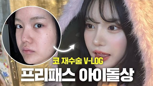 V LOG 썸네일 — 코 재수술 V-LOG 프리패스 아이돌상