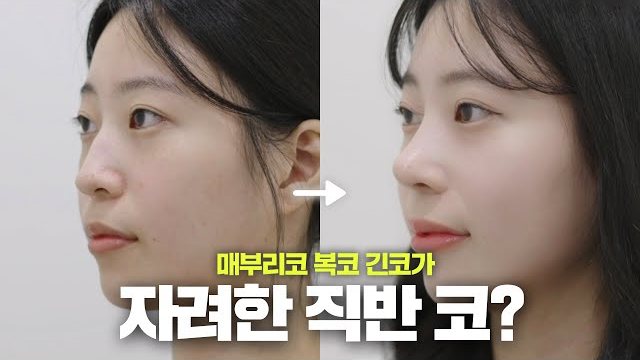 V LOG 썸네일 — 매부리코 복코 긴코가 자려한 직반 코?