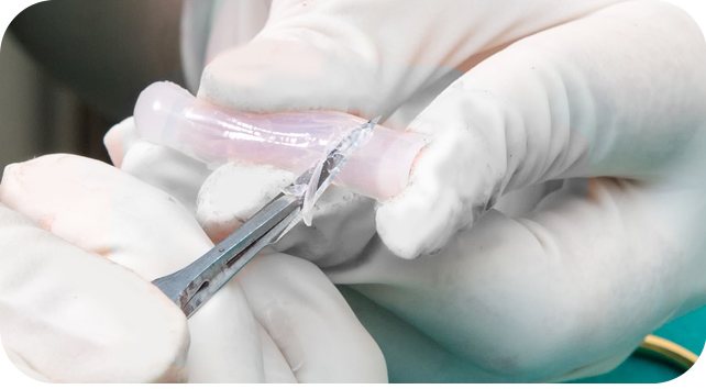 수술 장갑을 낀 손으로 코 보형물을 다듬는 모습