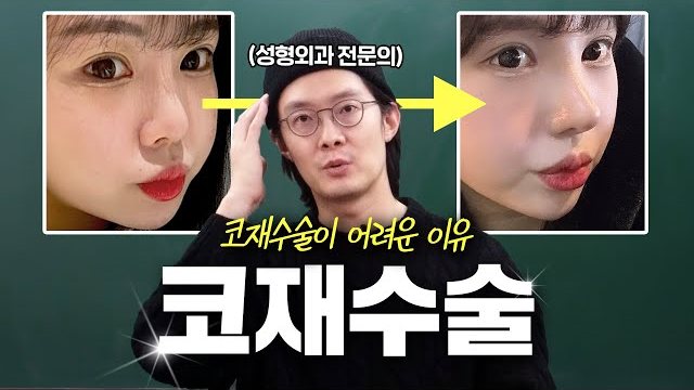 THEDOOR TV 썸네일 — (성형외과 전문의) 코재수술이 어려운 이유 코재수술