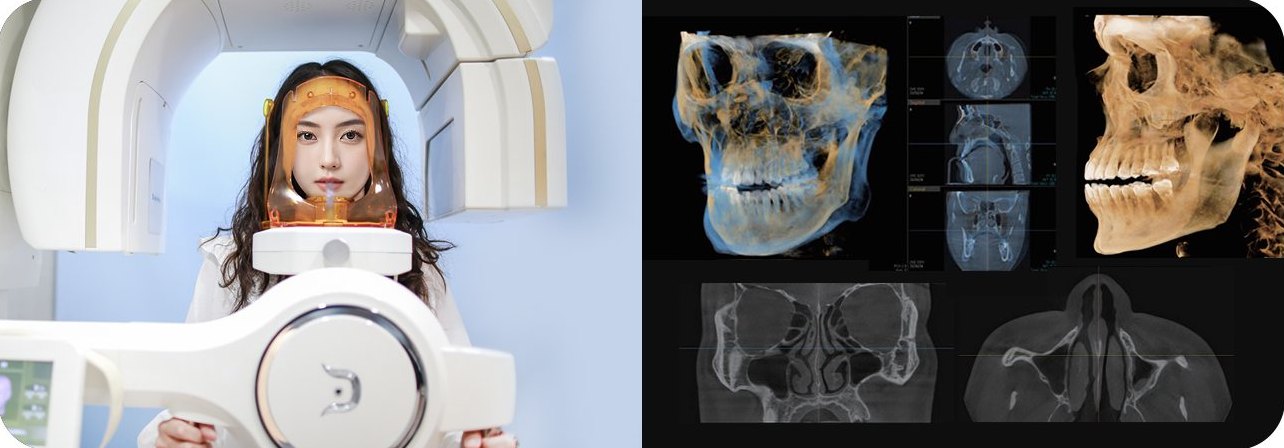3D CT 장비 안에서 촬영 자세를 잡은 여성(왼쪽) + 3D CT 두개골·코 단면 영상 화면(오른쪽)