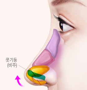 긴코·화살코 성형 설명 그림 — 옆모습 코 그림 — 콧기둥(비주)을 들어 올리는 화살표