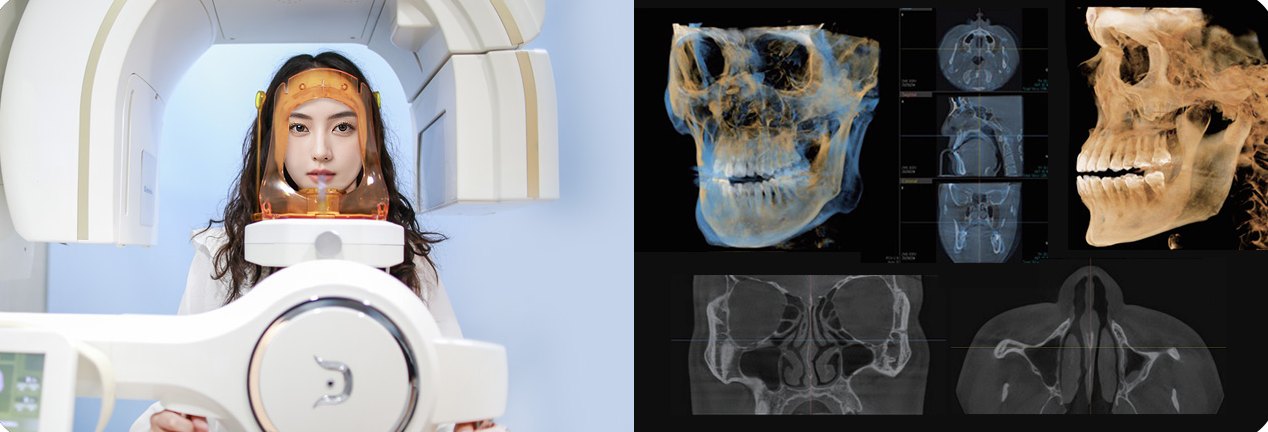 3D CT 장비 안에서 촬영 자세를 잡은 여성(왼쪽) + 3D CT 두개골·코 단면 영상 화면(오른쪽)